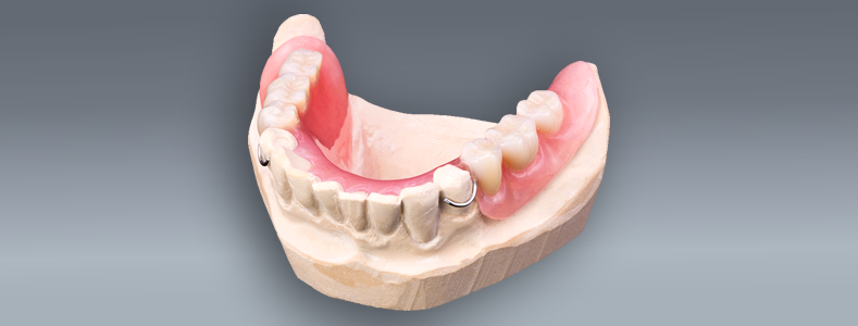 acrylic-partial-dentures