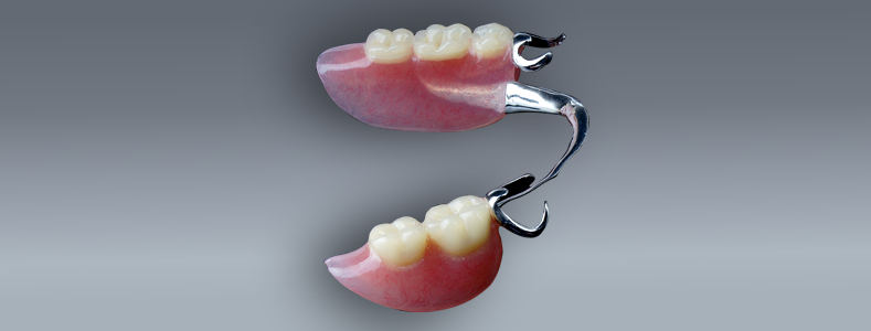 removable-cast-partial-dentures