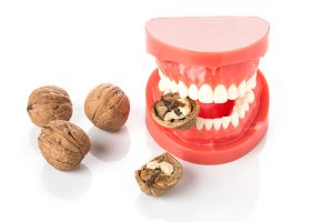 If You Have Dentures Avoid These 5 Foods - South Calgary Dentures - Denturists in Calgary