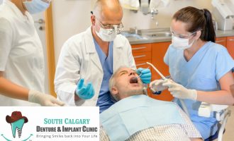 What You Need to Know About Denture Implants - South Calgary Dentures and Implants Clinic - Dentures and Implants Calgary